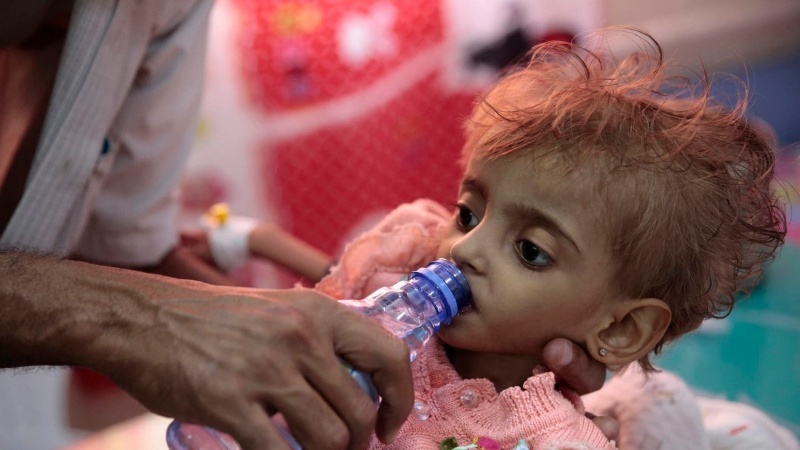 A malnourished Yemeni child