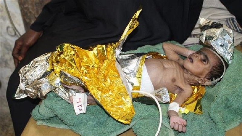Iranpress: UNICEF warns about starvation of children in Yemen