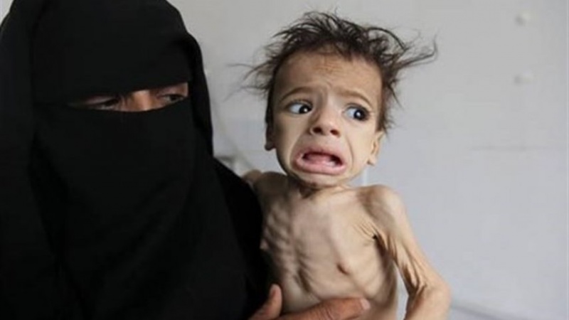 Iranpress: Yemen: 6 children die every hour from starvation 