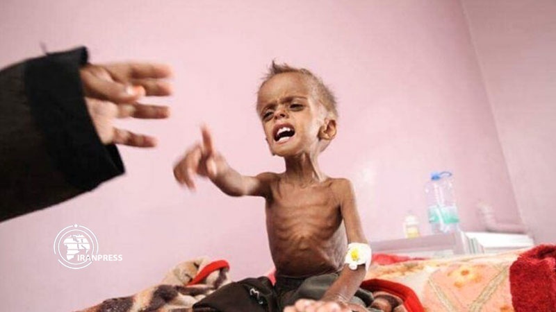 Iranpress: Above 800 Yemeni kids maimed in Saudi-led aggression: Spokesman