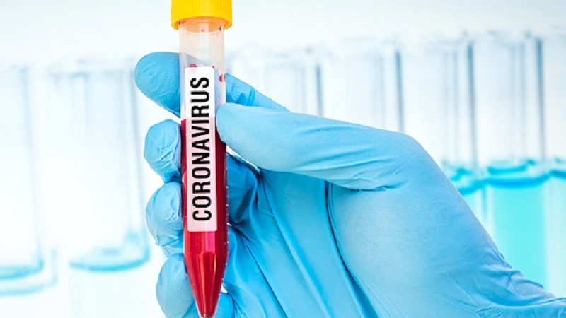 Iranpress: فرنسا تعلن وفاة مصاب بفيروس كورونا في هذا البلد
