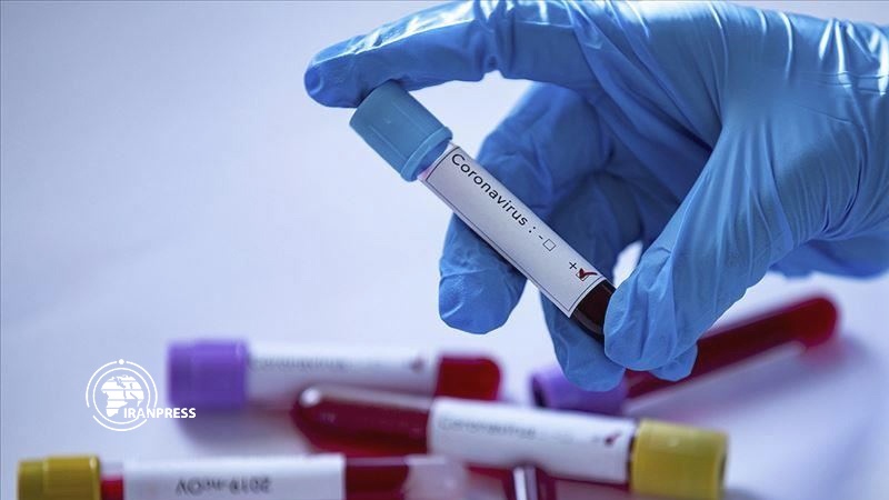 Iranpress: السعودية تسجل 205 حالات جديدة للإصابة بفيروس كورونا خلال يوم واحد