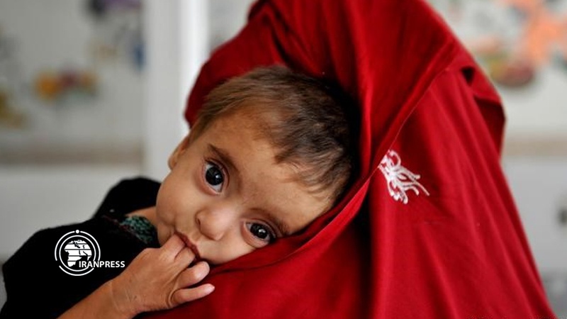 Iranpress: UNICEF: Millions of Yemeni children may starve amid pandemic