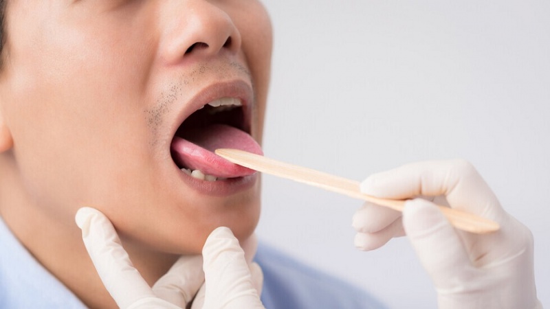 Iranpress: دراسة تربط بين مرض في الفم والوفاة بعدوى كورونا 