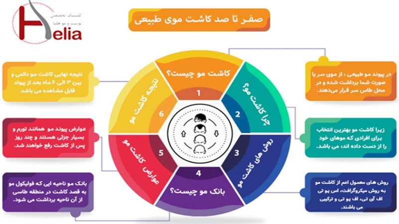 برای کاشت بهترین موی طبیعی کجا می‌روید؟