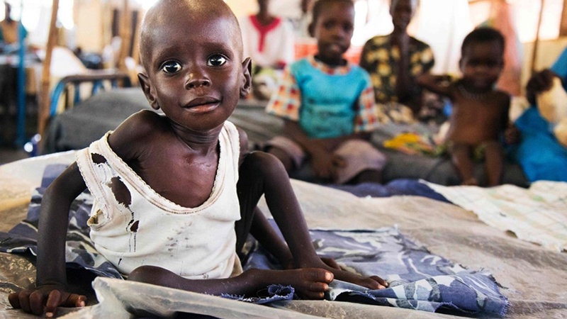 یونیسف: 3 میلیون کودک زیر 5 سال در سودان از سوء تغذیه رنج می‌برند