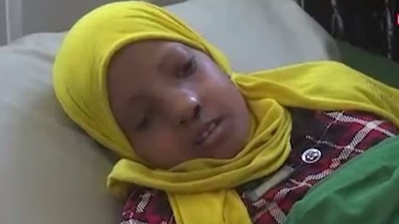 Iranpress: ارتفاع معدل إصابة الأطفال اليمنيين بالسرطان