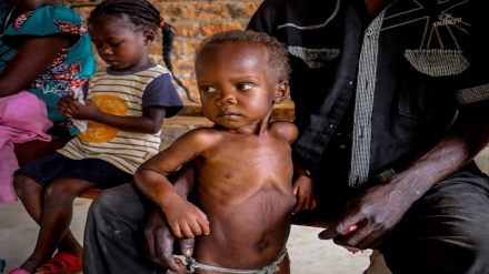   یک سوم کودکان در سودان دچار سوء تغذیه هستند 