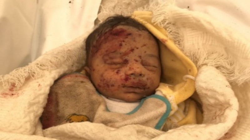 Iranpress:  أطباء بلا حدود: لا أحد ولا مكان آمنًا في غزة